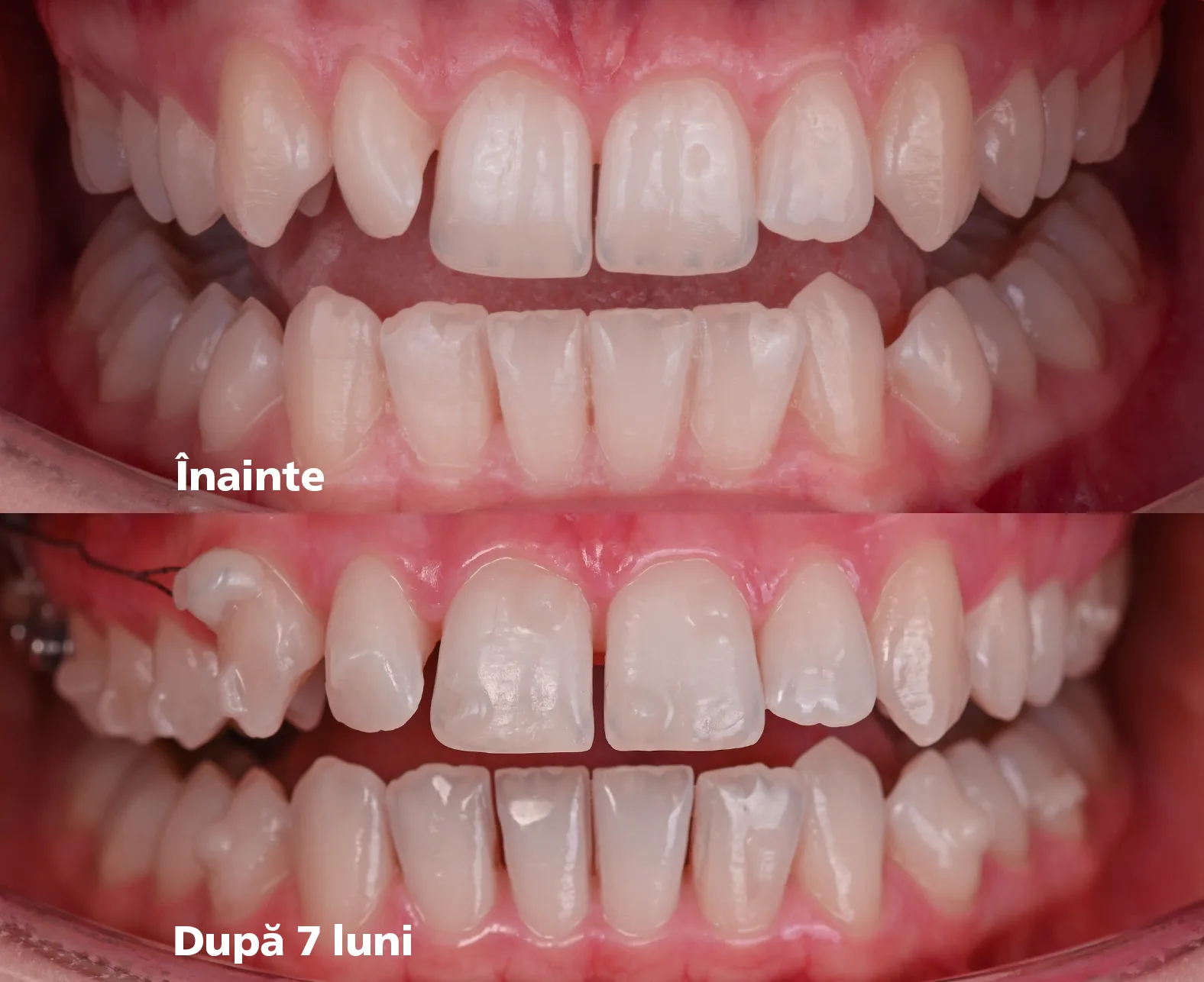 7 luni, o nouă comparație